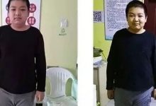 案例分享:肾病综合症(一个14岁男孩的抗病经历)-原始点全球同学网