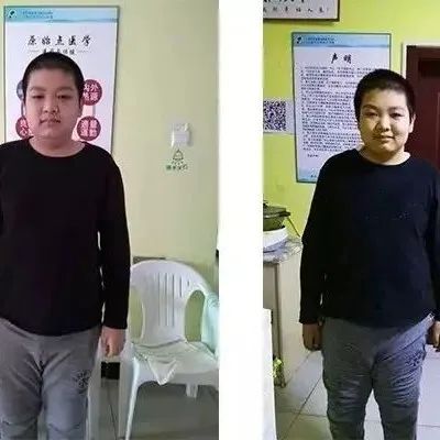 案例分享：肾病综合症（一个14岁男孩的抗病经历）-原始点全球同学网