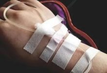 微问答46期:妈妈推拿调理之后,又偷偷跑去输液了 , 对身体会不会有伤害?-原始点全球同学网