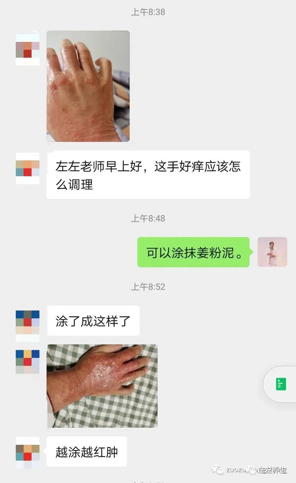 微问答99:子宫内膜增厚,温敷喝姜汤后,月经23天还流血…… 微问答99:子宫内膜增厚,温敷喝姜汤后,月经23天还流血……
