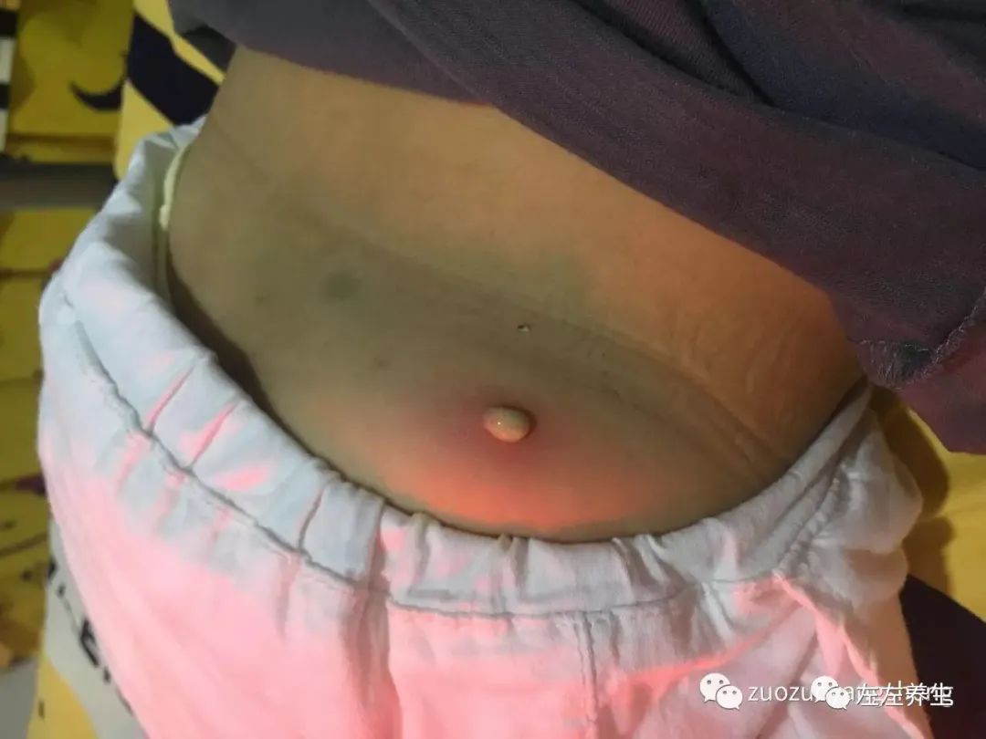 小孩调理过程中所出现的好转反应大总结 小孩调理过程中所出现的好转反应大总结