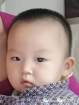 案例分享:周岁小孩持续高烧、频繁惊厥案例 案例分享:周岁小孩持续高烧、频繁惊厥案例