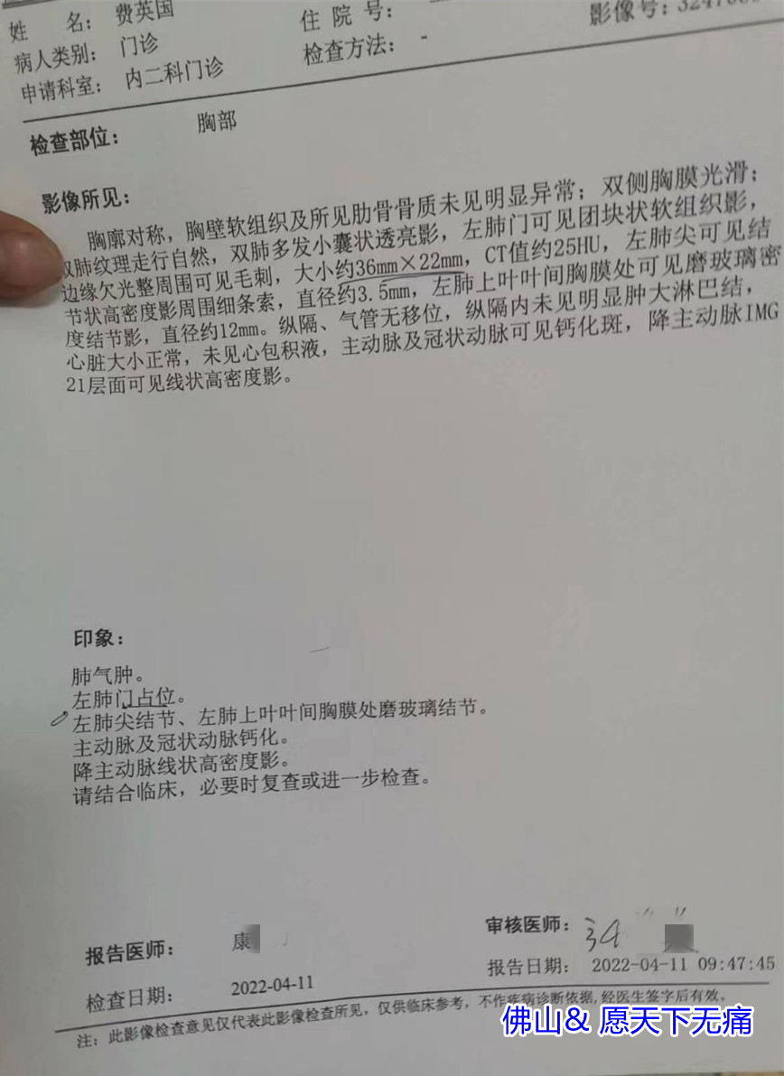 原始点调理肺（鳞状细胞）癌案例 - 肺结核  肺气肿  肺癌 - 佛山愿天下无痛