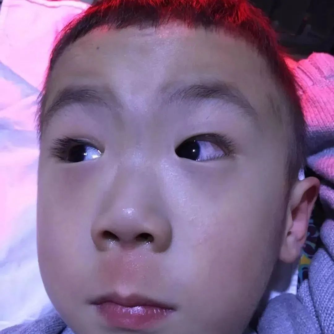 案例分享：4岁小孩角膜炎调理案例-原始点全球同学网