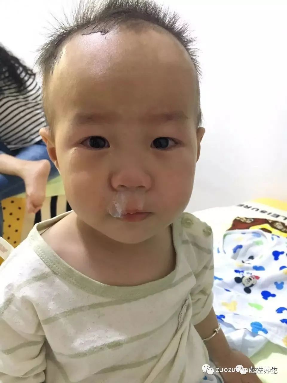 案例分享:小孩咳嗽后出现严重好转反应 案例分享:小孩咳嗽后出现严重好转反应