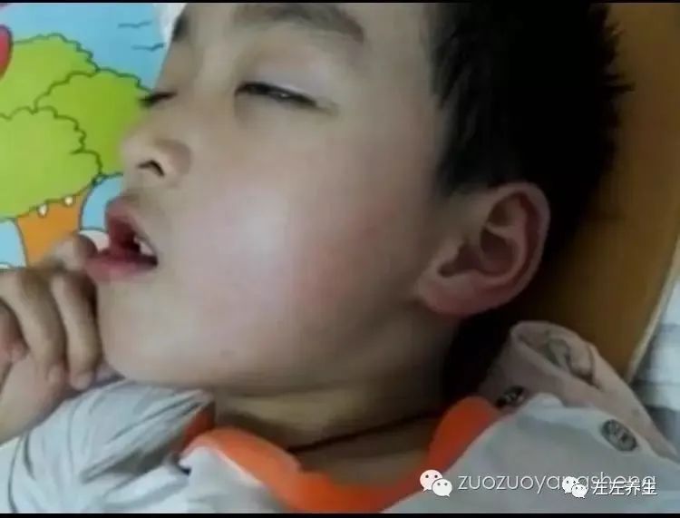 调理孩子感冒发烧的时候，资深老师最担心的是什么？