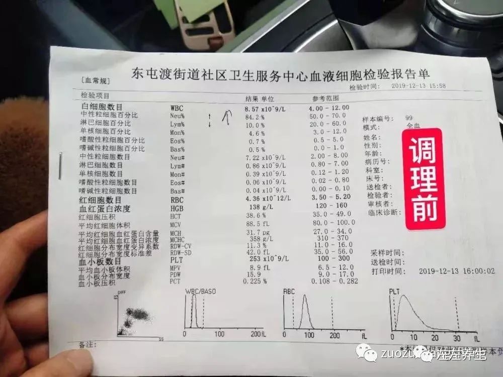 案例分享:甲流调理案例 案例分享:甲流调理案例