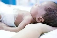 微问答28期:到了医疗的极限,华佗再世也回天乏术-原始点全球同学网