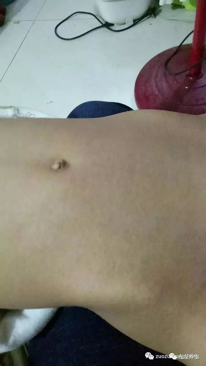 小孩调理过程中所出现的好转反应大总结 小孩调理过程中所出现的好转反应大总结