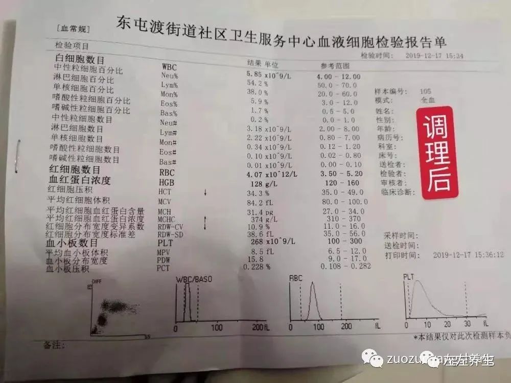 案例分享:甲流调理案例 案例分享:甲流调理案例