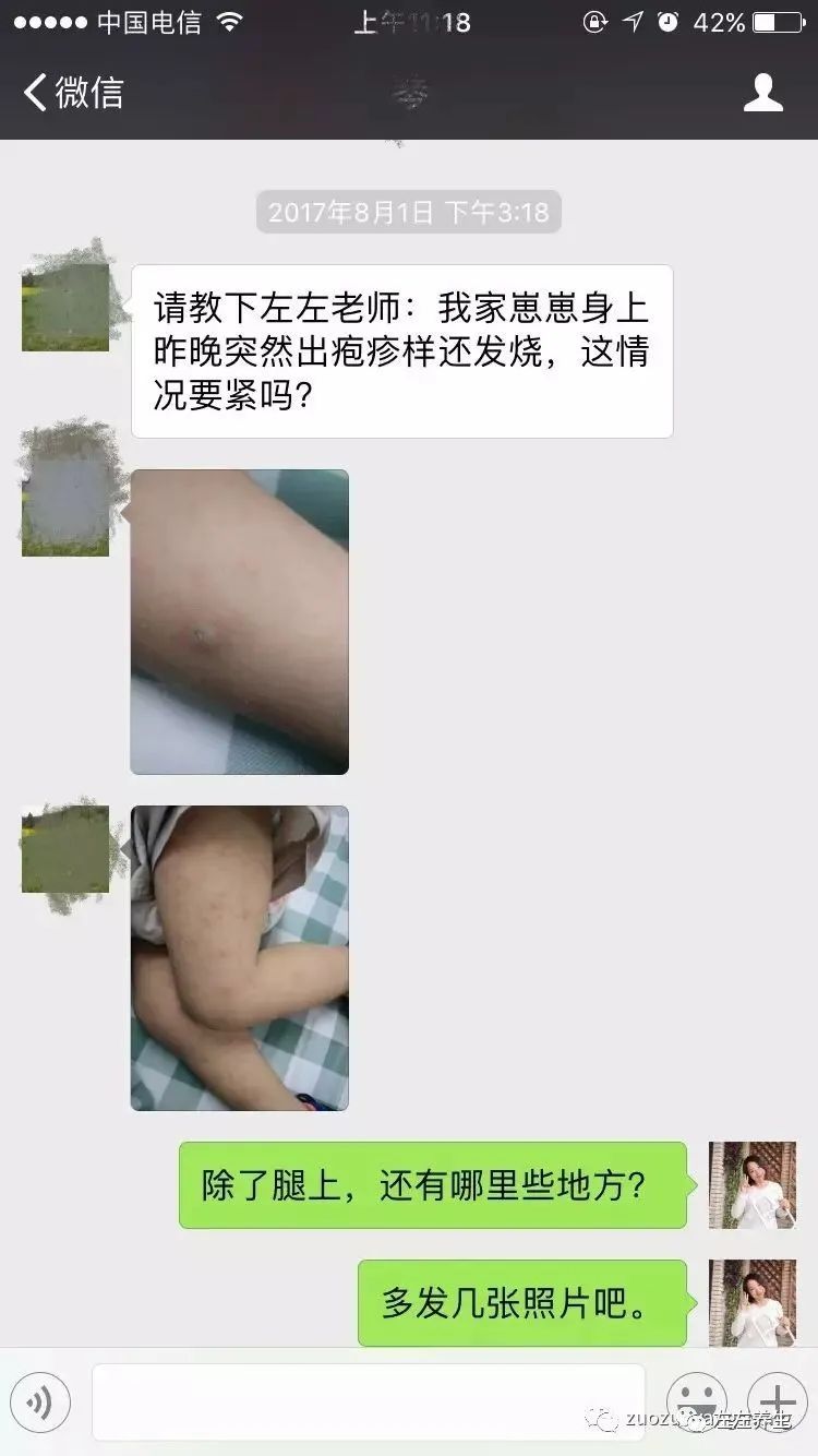 案例分享:小孩咳嗽后出现严重好转反应 案例分享:小孩咳嗽后出现严重好转反应