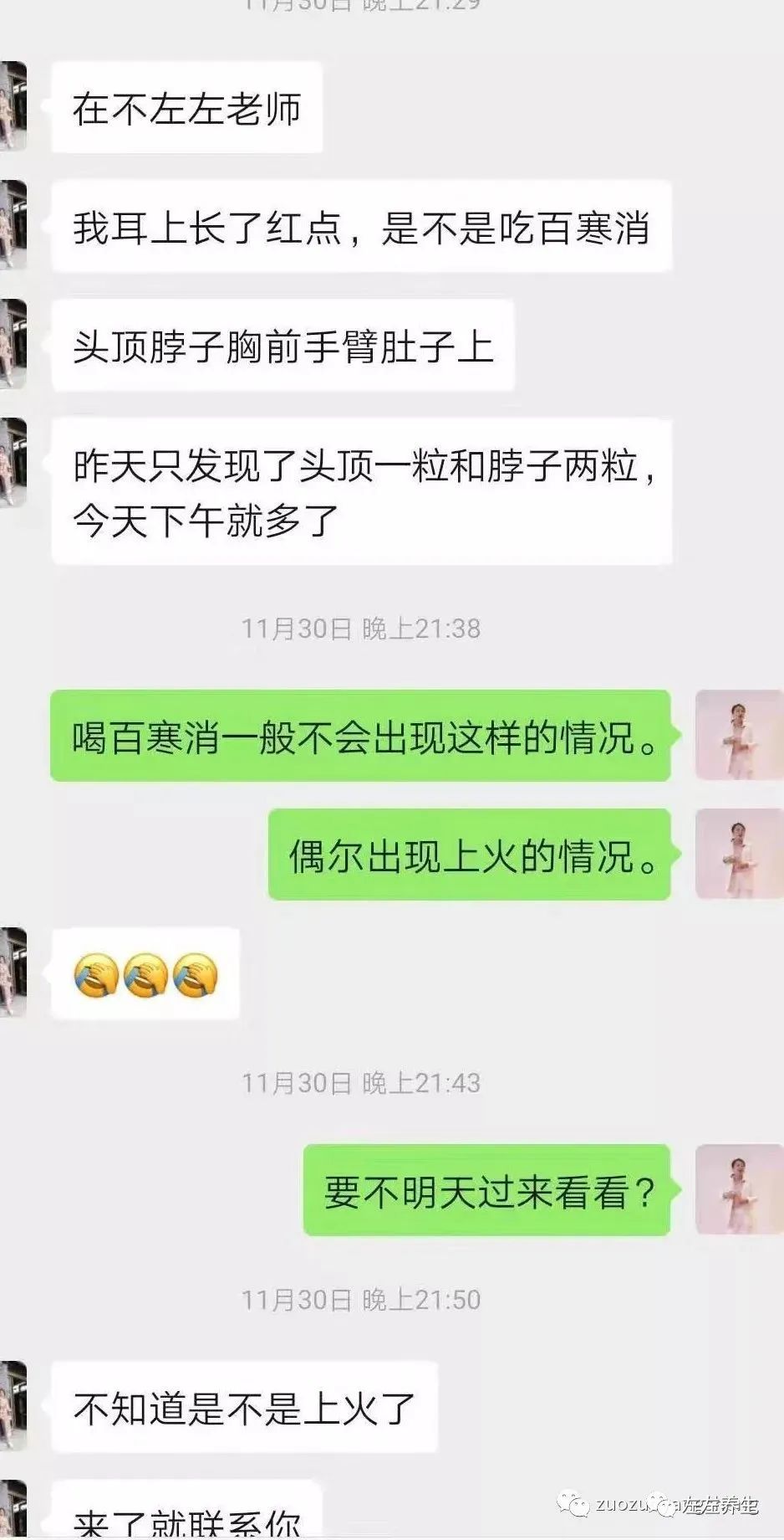 案例分享：成人水痘调理案例