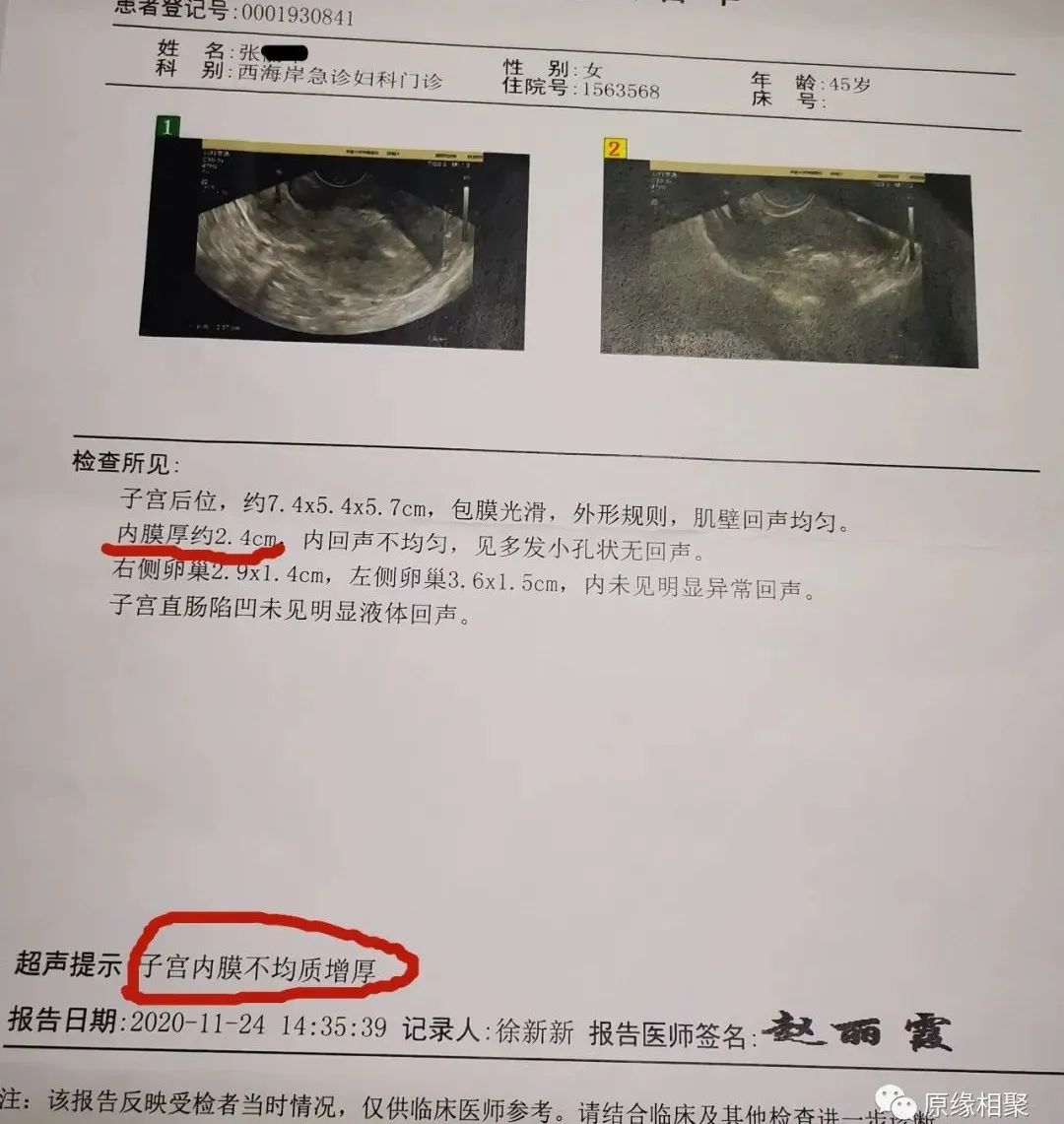 子宫内膜增厚 子宫内膜增厚