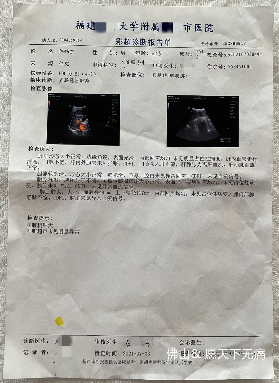 原始点调理直肠癌术后肺部转移  腰酸痛案例 - 直肠癌  结肠癌 - 佛山愿天下无痛