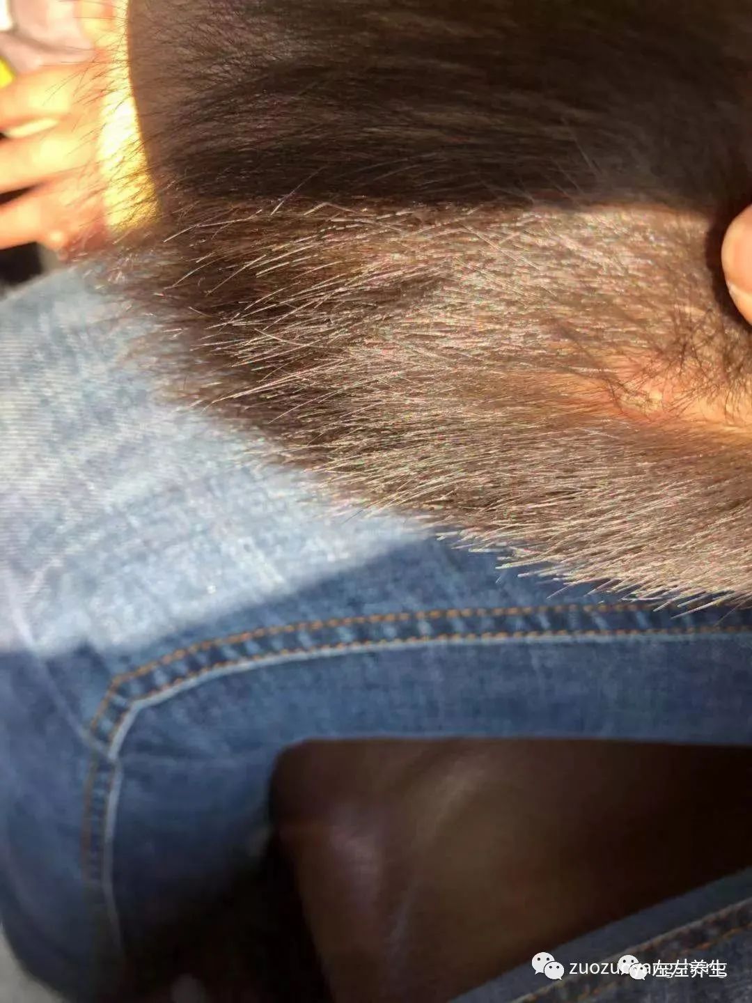 案例分享:小孩水痘以及右腿扭伤无法下地调理案例 案例分享:小孩水痘以及右腿扭伤无法下地调理案例