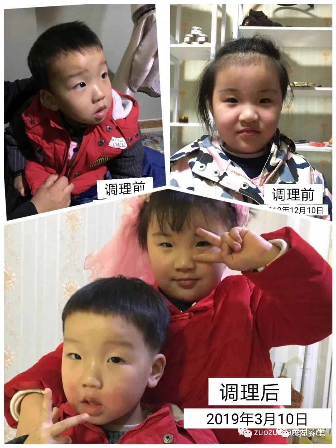 案例分享：摆脱打针吃药痛苦——两孩子哮喘、咳喘、湿疹、鼻塞、体质弱调理案例