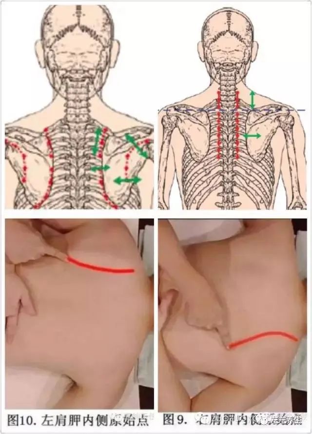 微问答51期：乳腺增生多年，常胀痛，这样下去会患乳腺癌吗？