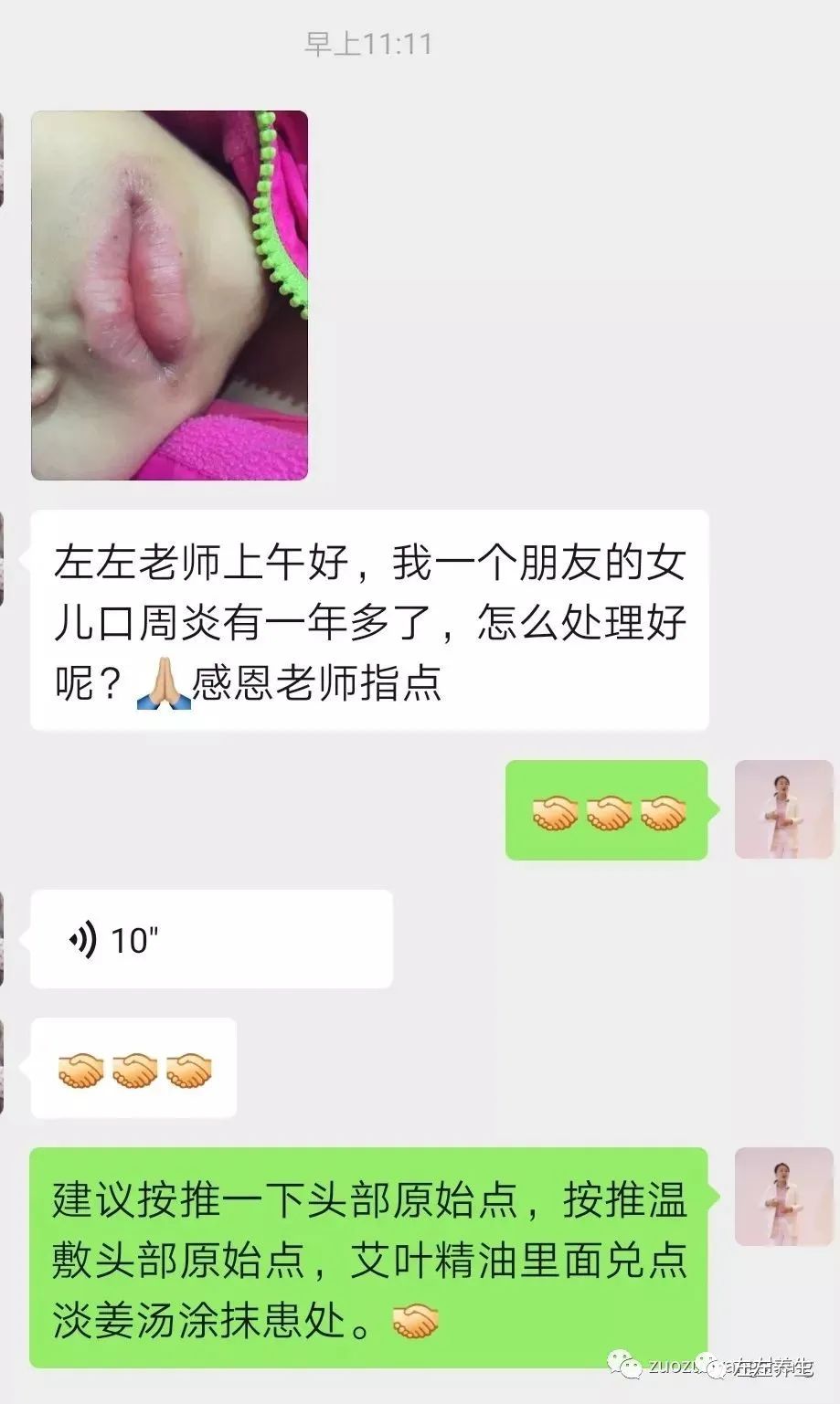 微问答56期:如何让家人配合调理孩子过敏性鼻炎? 微问答56期:如何让家人配合调理孩子过敏性鼻炎?