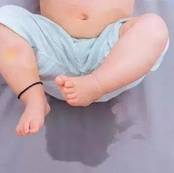 微问答133期：孩子尿频怎么办？-原始点全球同学网