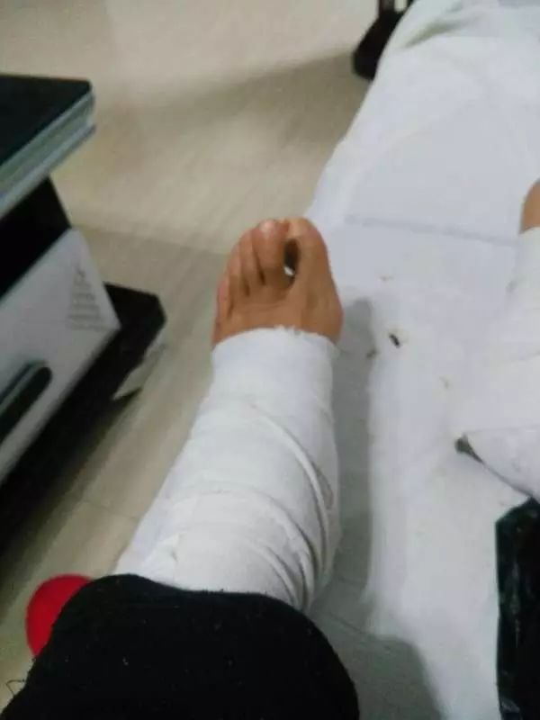 案例:我终于扔掉了双拐 案例:我终于扔掉了双拐