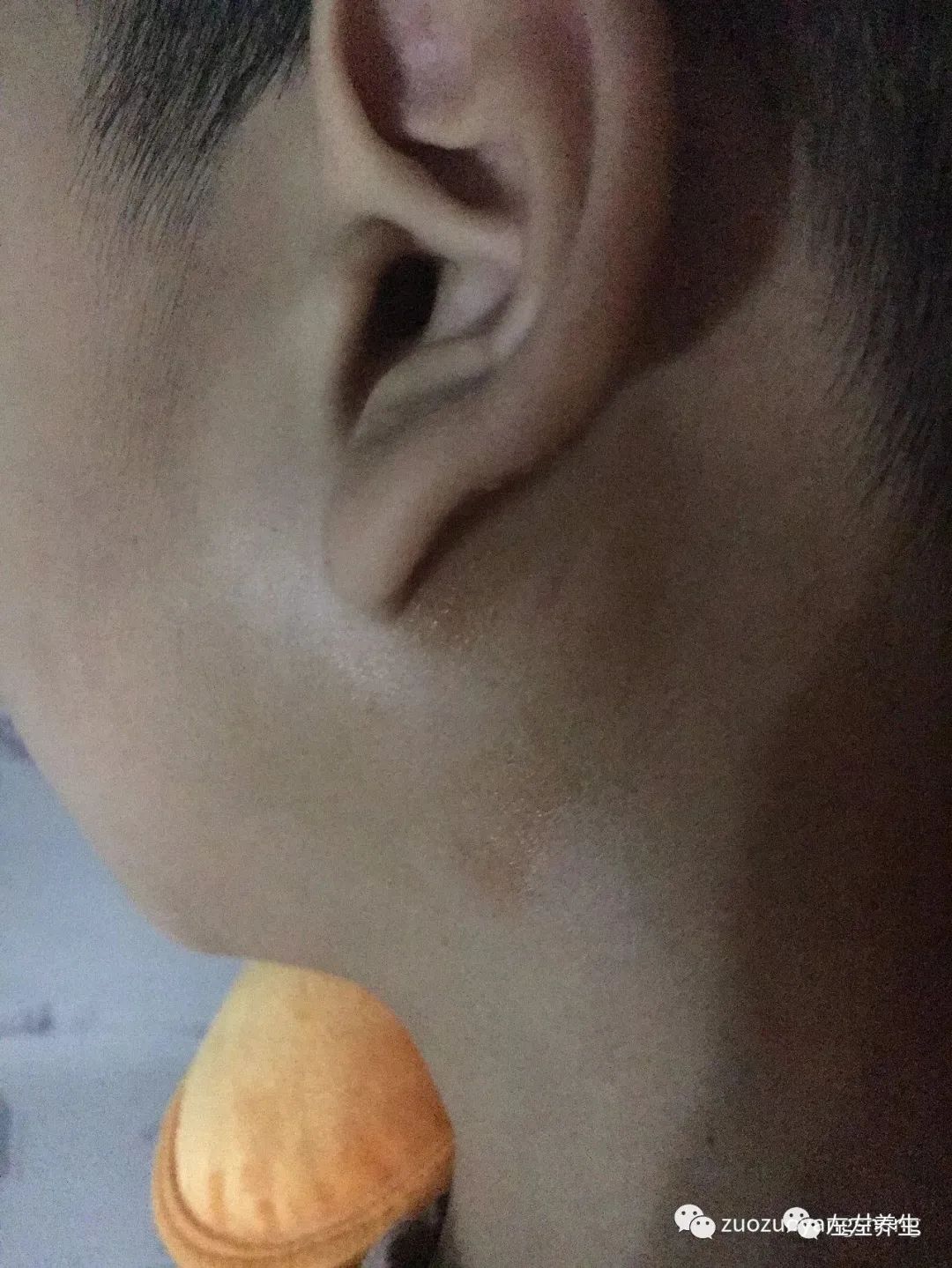 案例分享：儿子腮腺炎调理案例