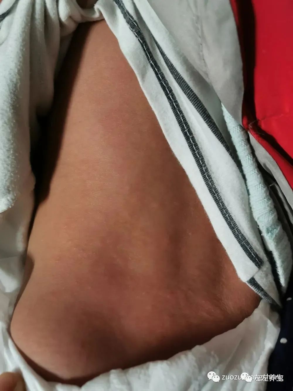 案例分享：婴幼儿急诊与反复高烧调理案例