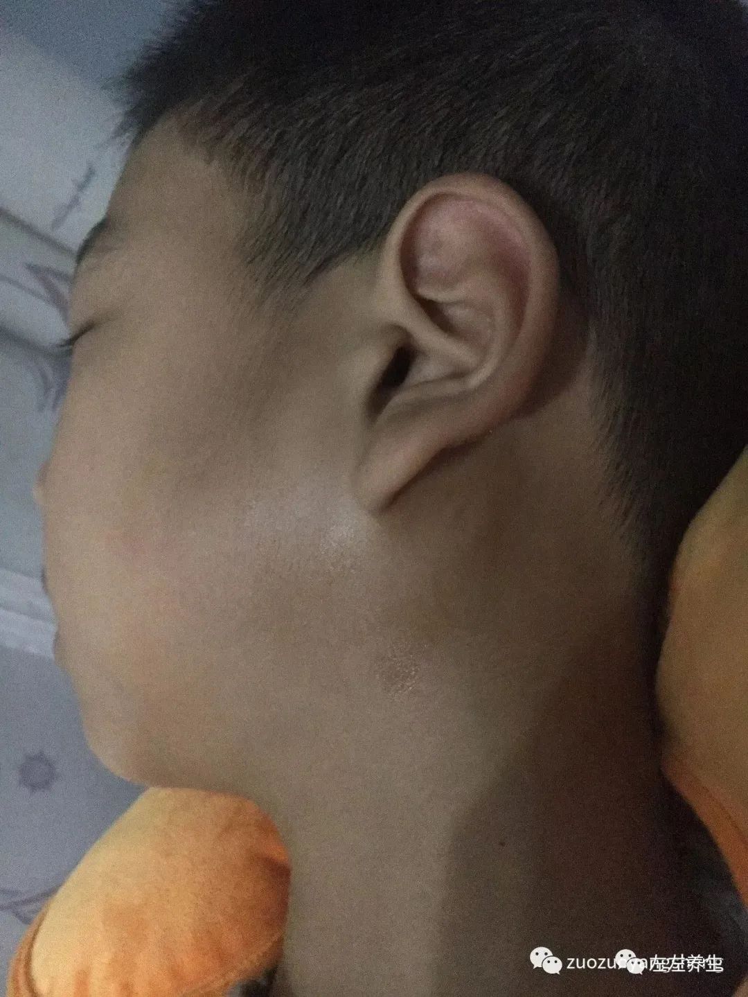 案例分享：儿子腮腺炎调理案例