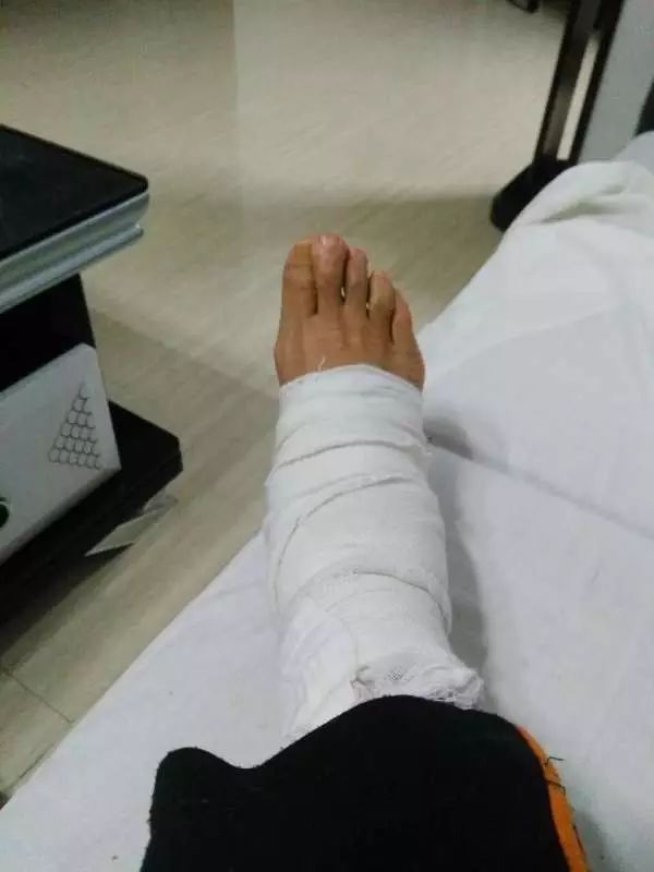 案例:我终于扔掉了双拐 案例:我终于扔掉了双拐