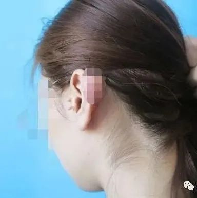 案例分享：8岁小孩左耳突然疼痛难忍调理案例-原始点全球同学网