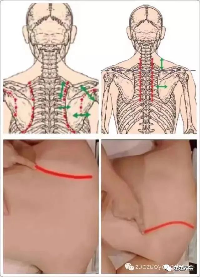 “阳康”后,身体面临的后遗症如何调理? “阳康”后,身体面临的后遗症如何调理?