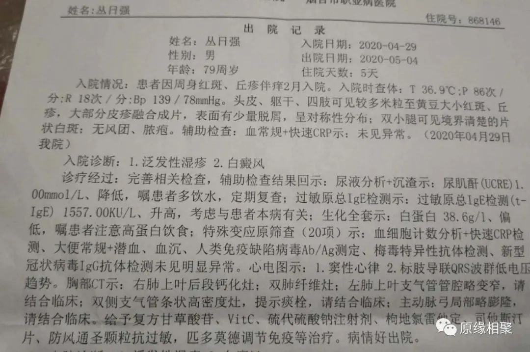 泛发性湿疹 泛发性湿疹