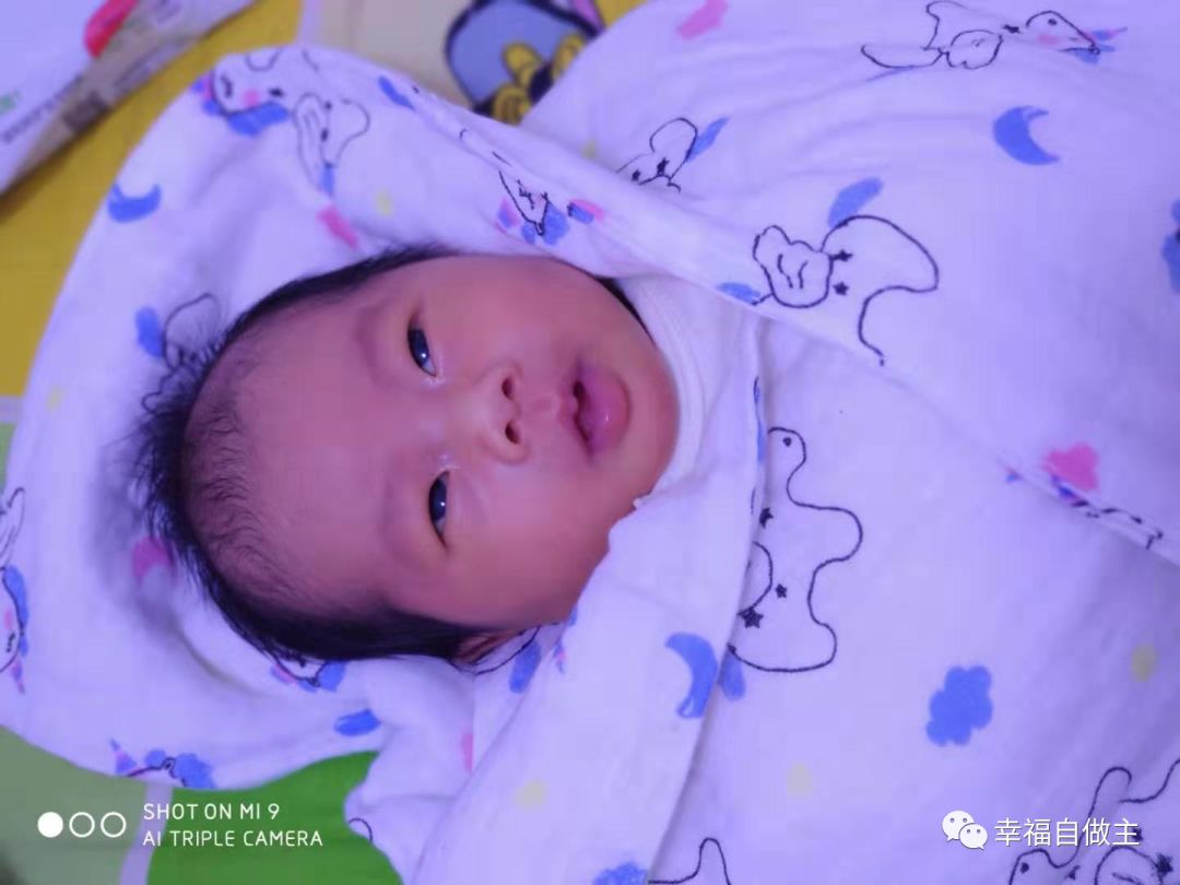 婴儿黄疸怎么办？方法竟然如此简单！