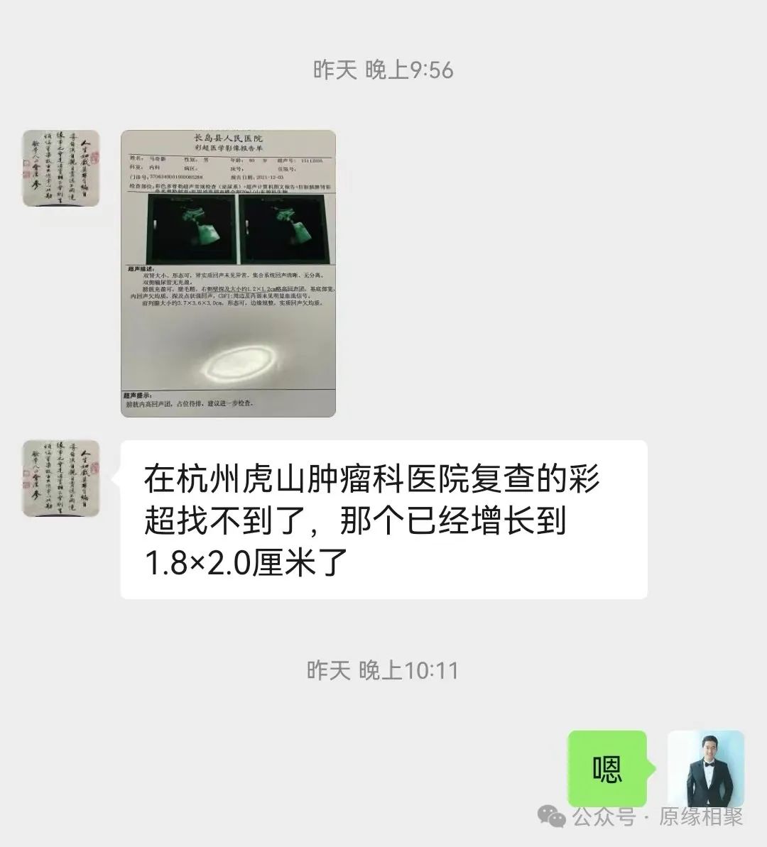 膀胱恶性肿瘤 膀胱恶性肿瘤