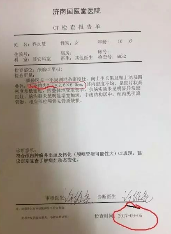 原始点案例|脑瘤 原始点案例|脑瘤