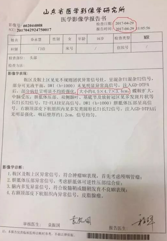 原始点案例|脑瘤 原始点案例|脑瘤