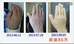 [XNGL[E6@9)[6{Z~4Y6)XMP [XNGL[E6@9)[6{Z~4Y6)XMP