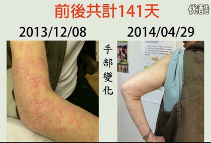 ZESMN4L`2BL3Z6[03O4MI~T ZESMN4L`2BL3Z6[03O4MI~T